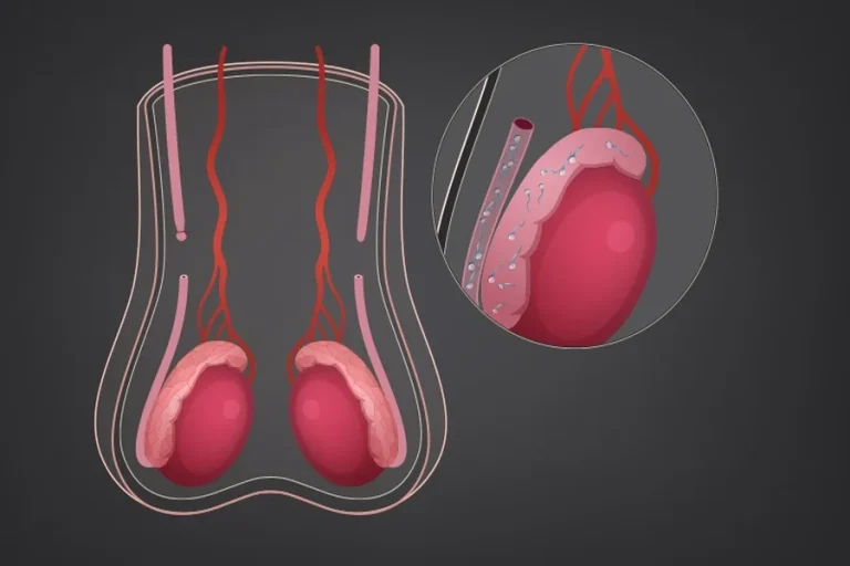 How Vasectomy Procedures Have Changed Over the Years How Vasectomy Procedures Have Changed Over the Years